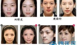 福州整形爆料事件视频最新,揭露行业黑幕，真相令人震惊